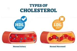 Diferenças entre Colesterol HDL e LDL